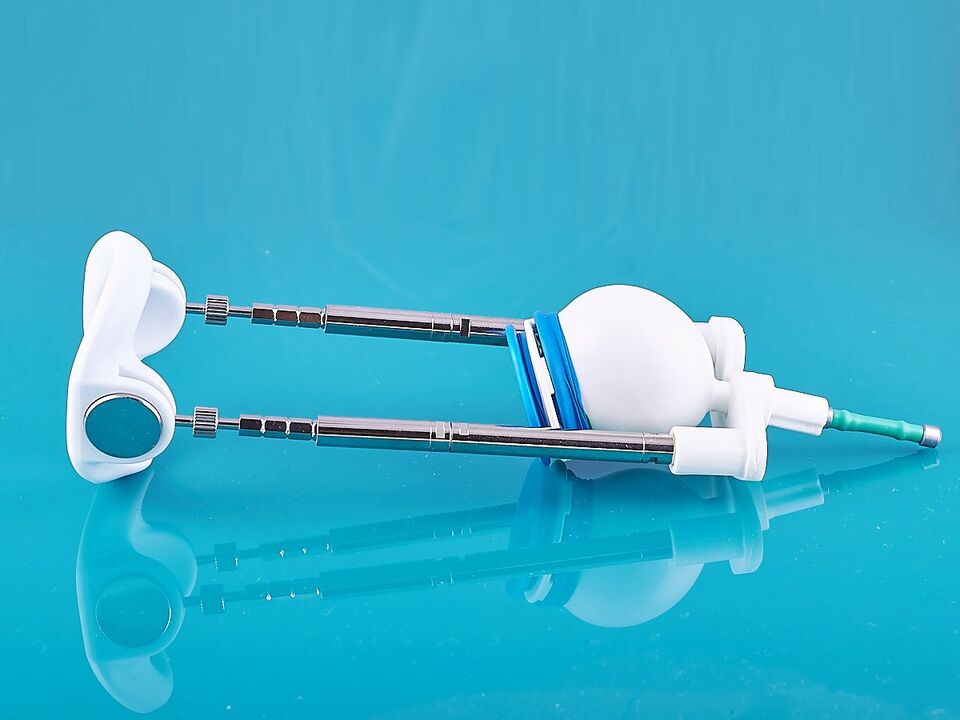 Extender – ein Gerät zur Vergrößerung des Penis